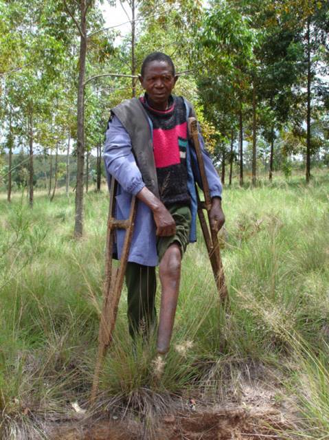 Burundi LandmineSurvivor